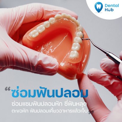 ซ่อมฟันปลอม