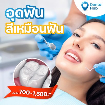 อุดฟันสีเหมือนฟัน