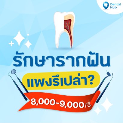 รักษารากฟันแพงรึป่าว?