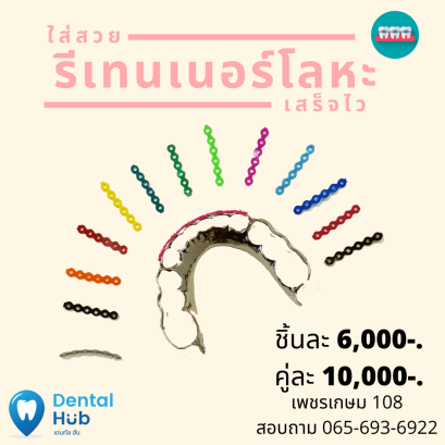รีเทนเนอร์โลหะ ทางเลือกใหม่หลังจัดฟัน
