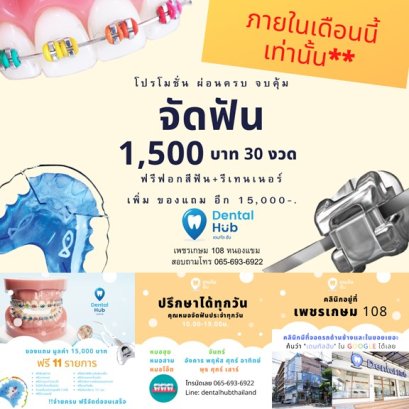 โปรจัดฟัน 1,500 บาท ผ่อนครบ จบ คุ้ม