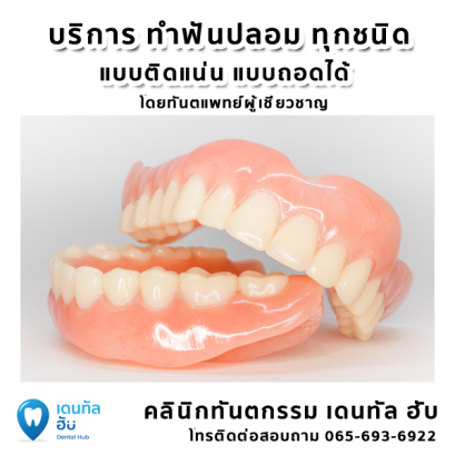 รับทำ ฟันปลอม ทุกชนิด ทั้งถอดได้และติดแน่น