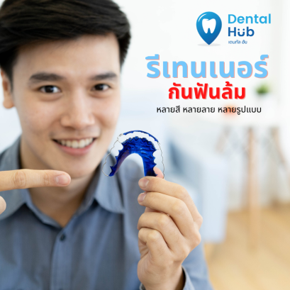 รีเทนเนอร์ เพียงชิ้นละ 2500-. สีสด ใส่ง่าย 