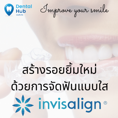 โปรโมชั่น จัดแบบใส ระบบ invisalign ผ่อนสบาย ราคาเอื้อมถึง