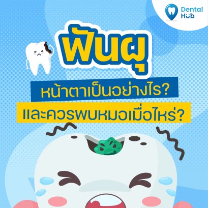 ฟันผุหน้าตาเป็นอย่างไร?