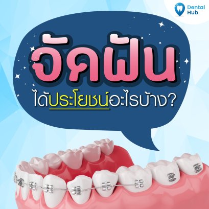 จัดฟันได้ประโยชน์อะไร ?