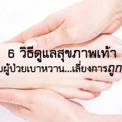 6 วิธีดูแลสุขภาพเท้าสำหรับผู้ป่วยเบาหวาน เลี่ยงการถูกตัดขา