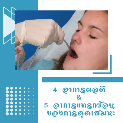 4 อาการผลดี และ 5 อาการแทรกซ้อนของการดูดเสมหะ