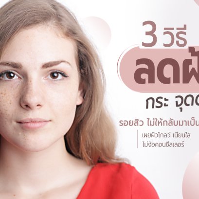 3 วิธีลดฝ้า กระ จุดด่างดำ รอยสิว ไม่ให้กลับมาเป็นซ้ำ เผยผิวโกลว์ เนียนใส  ไม่ง้อคอนซีลเลอร์