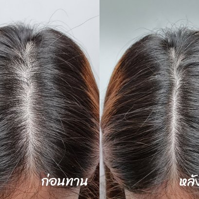 [รีวิว] หลังคลอดน้องปันฝัน ขอบอกเลยว่า ผมหลุดร่วงแบบน่ากลัวมาก