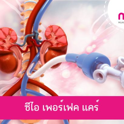 ซีไอ เพอร์เฟค แคร์ (CI Prefect Care)