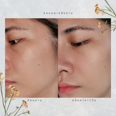 HARRIS Marine Q10 ผิวสวยใส ลดริ้วรอย จบใน 1 เดียว