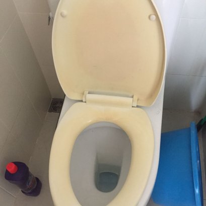 7 ขั้นตอน วิธีกำจัดคราบเหลืองบนฝาชักโครก