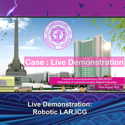 VDO Rerun Rajavithi ASEAN Colorectal Minimal Invasive Surgery Conference 2024