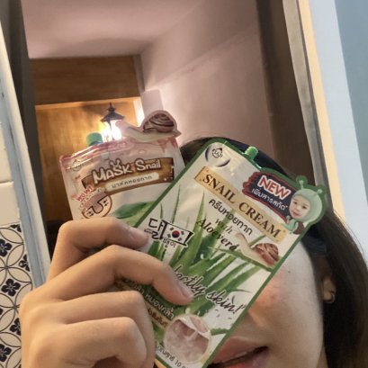 แชร์ประสบการณ์จริงจากเราที่เป็นสิวหนัก ทำไงให้หาย