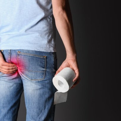 ริดสีดวงแตก