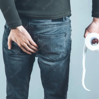 วิธีลดอาการปวดริดสีดวงเมื่อมีอาการ