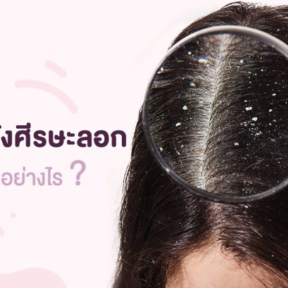 รังแคกับอาการหนังศีรษะลอกต่างกันอย่างไร?