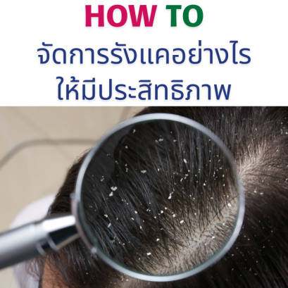 How_to_จัดการรังแคอย่างมีประสิทธิภาพ