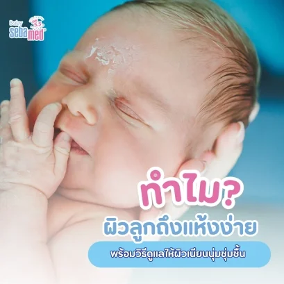 ทำไมผิวลูกแพ้ง่าย