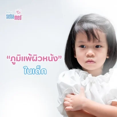 ภูมิแพ้ผิวหนัง