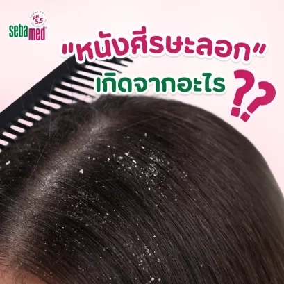 หนังศีรษะลอกเกิดจากอะไร