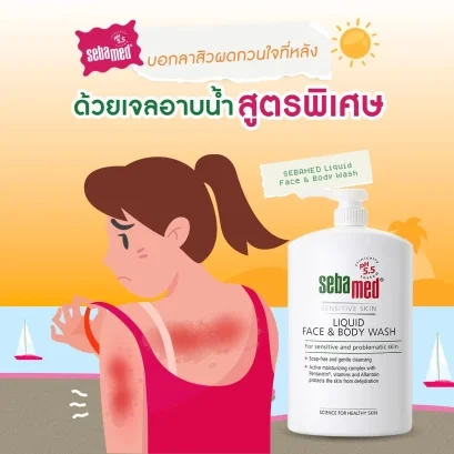 บอกลาสิวที่หลัง