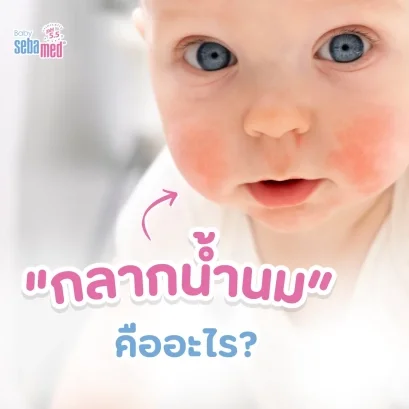 กลากน้ำนมคืออะไร