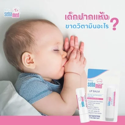 เด็กปากแห้งขาดวิตามินอะไร? ไขข้อสงสัยและวิธีดูแล