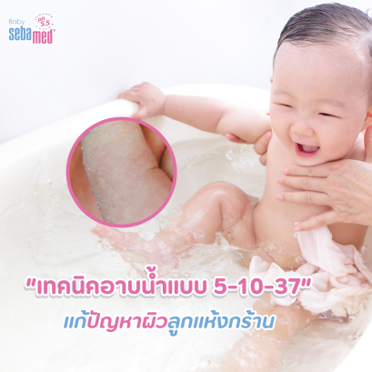 เทคนิคอาบน้ำแบบ 5-10-37 แก้ปัญหาผิวลูกแห้งกร้าน