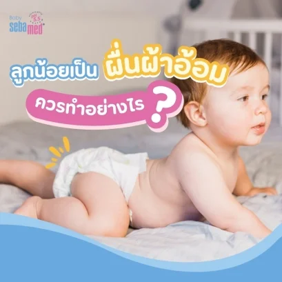 ลูกน้อยเป็นผื่นผ้าอ้อม_ควรทำอย่างไร