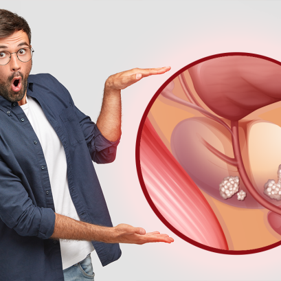 ทำไมถึงเป็นต่อมลูกหมากโต