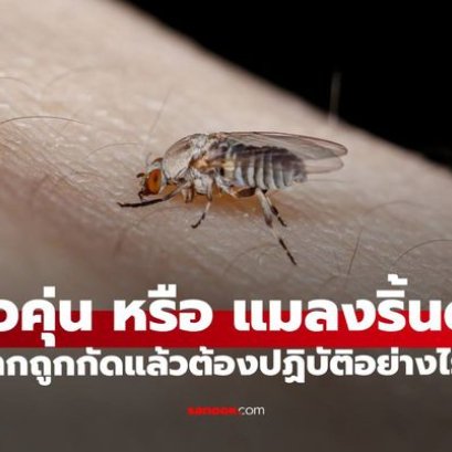"ตัวคุ่น" คืออะไร ทำความรู้จักแมลงจิ๋วกัดเจ็บ เช็กเลยอาการแพ้ที่ต้องรีบพบแพทย์