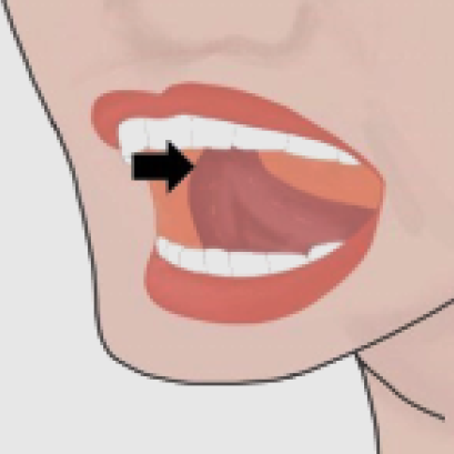 การออกกำลังกายช่องปากและคอหอย แก้นอนกรน