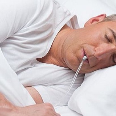 INAP therapy ... วิธีใหม่ในการรักษานอนกรน