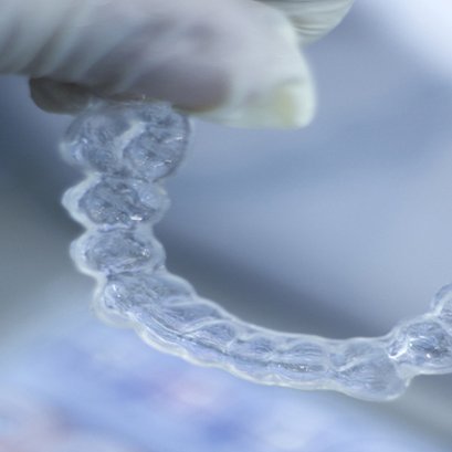 อุปกรณ์ในช่องปาก (oral appliance) รักษานอนกรน หยุดหายใจ 