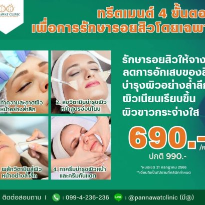 ทรีต​เมนต์​ 4 ขั้นตอน​​ เพื่อการรักษา​รอยสิวโดยเฉพาะ​