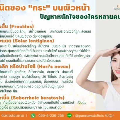 ชนิดของ ❗️กระ 