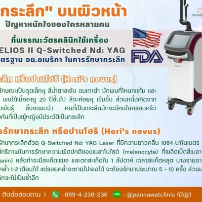 ❗❗"ก​ระลึก​" บนผิวหน้า❗❗ ปัญหาหนักใจของใครหลายคน