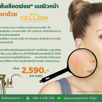 "เส้นเลือดฝอย" 