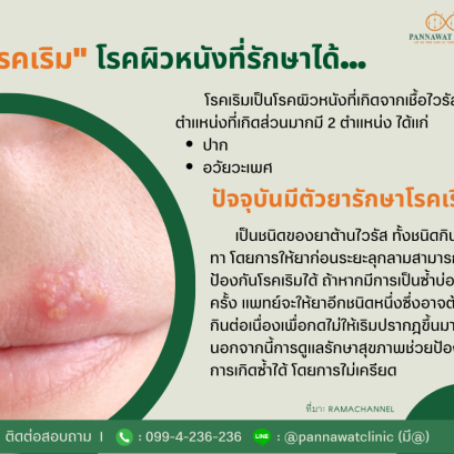 "โรคเริม" โรคผิวหนังที่รักษาได้...