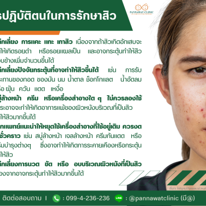 การปฏิบัติตนในการรักษาสิว