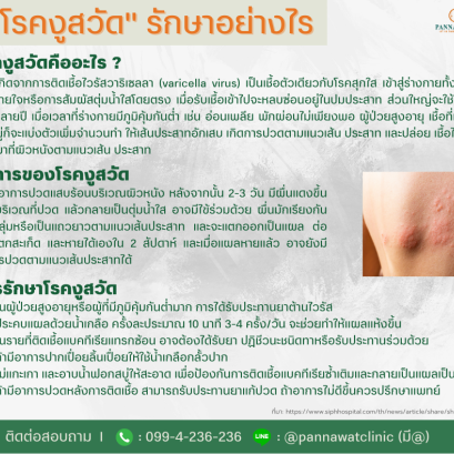 "โรคงูสวัด" รักษาอย่างไร