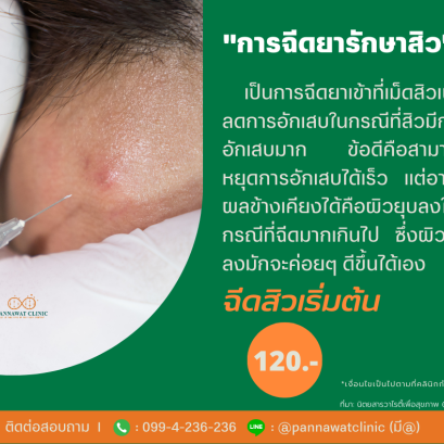 การฉีดยารักษาสิว