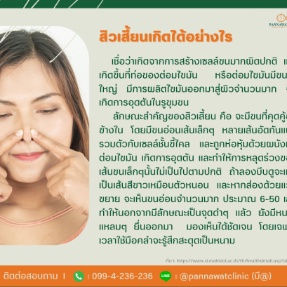 ❗️❗️ สิวเสี้ยนเกิดได้อย่างไร ❗️❗️