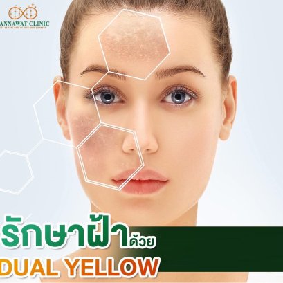 รักษาฝ้าด้วย​โปรแกรม​ Dual Yellow