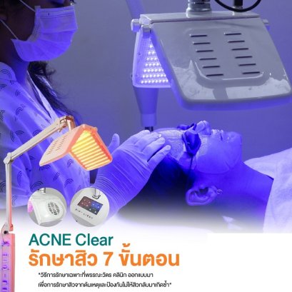 การรักษาสิว 7 ขั้นตอน