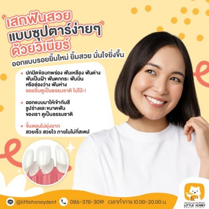 วีเนียร์ ดียังไง