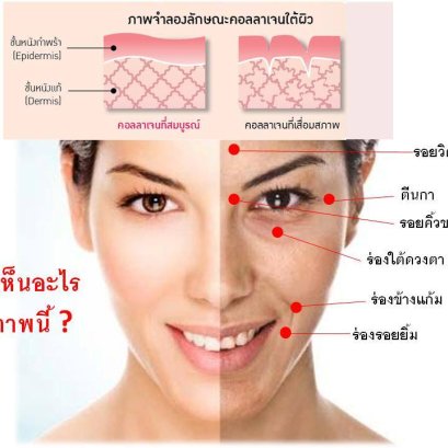 เช็ค 3 อาการ ร่างกายขาด คอลาเจนไหม?