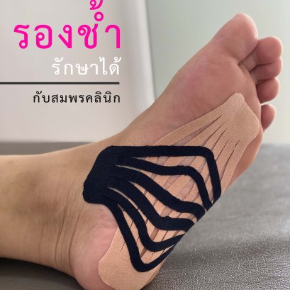 รองช้ำ รักษาได้